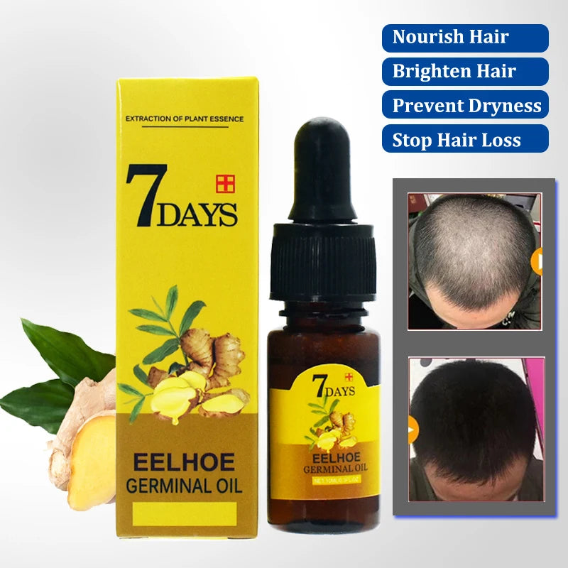 Ginger Hair Oil – Hydrate & Repair Dry Hair