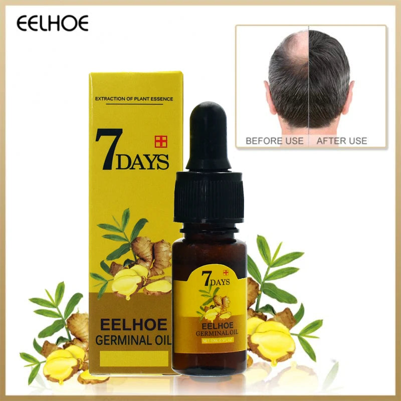 Ginger Hair Oil – Hydrate & Repair Dry Hair