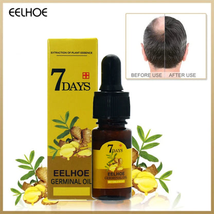 Ginger Hair Oil – Hydrate & Repair Dry Hair