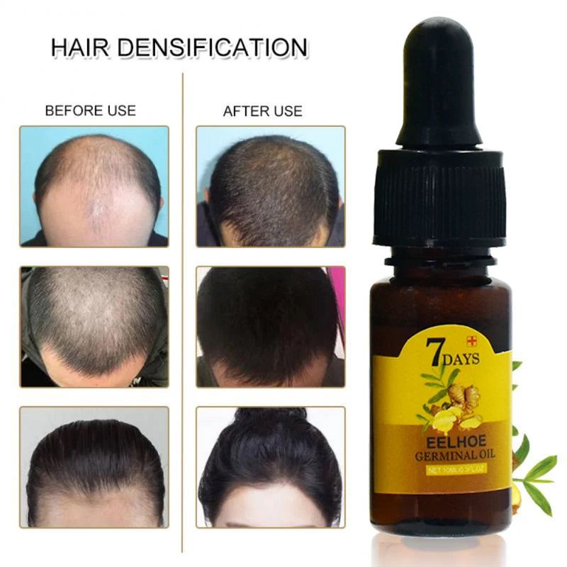Ginger Hair Oil – Hydrate & Repair Dry Hair